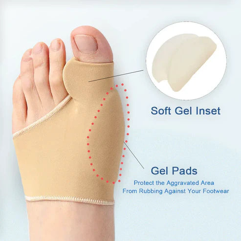 HalluxNext™ Bunion Sleeve